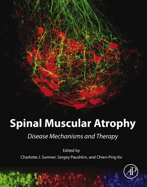 Spinal Muscular Atrophy - 