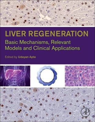 Liver Regeneration - 