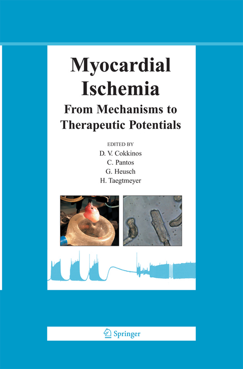 Myocardial Ischemia - 