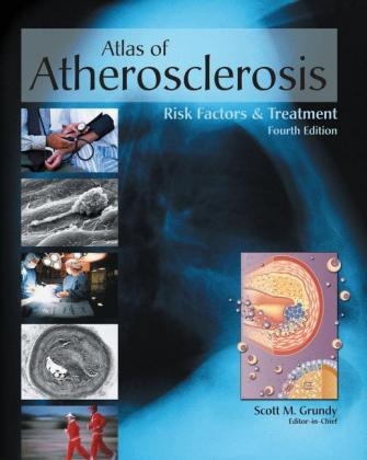 Atlas of Atherosclerosis and Metabolic Syndrome - 