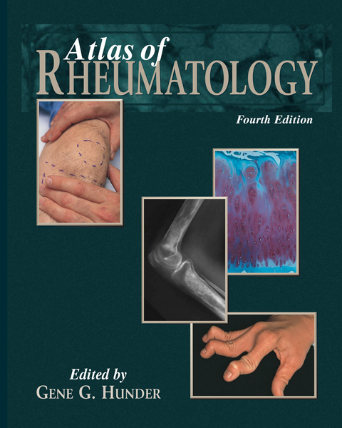 Atlas of Rheumatology - 