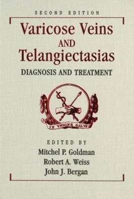 Varicose Veins and Telangiectasias - 