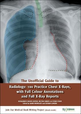 The Unofficial Guide to Radiology: 100 Practice Chest X Rays with Full Colour Annotations and Full X Ray Reports - Mohammed Rashid Akhtar, Rebecca Best, Lydia Shackshaft, Mark A Rodrigues, Zeshan Qureshi