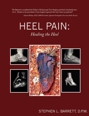 Heel Pain - D.P.M. Stephen L. Barrett