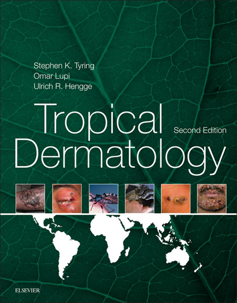 Tropical Dermatology -  Ulrich R Hengge,  Omar Lupi,  Steven K Tyring