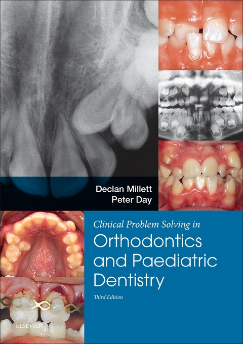 Clinical Problem Solving in Orthodontics and Paediatric Dentistry E-Book -  Peter Day,  Declan Millett
