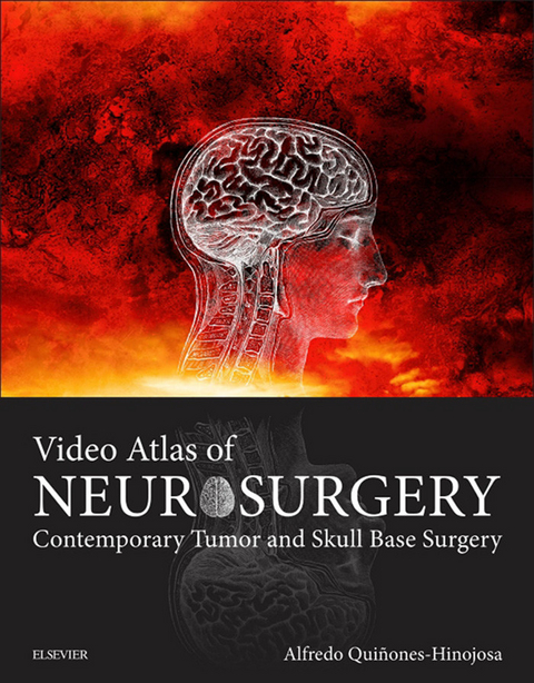 Video Atlas of Neurosurgery -  Alfredo Quinones-Hinojosa