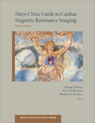 Mayo Clinic Guide to Cardiac Magnetic Resonance Imaging - Kiaran McGee, Matthew Martinez, Eric Williamson