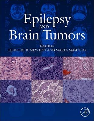 Epilepsy and Brain Tumors - 