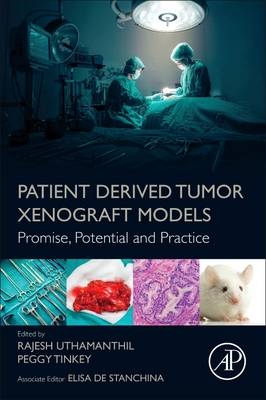 Patient Derived Tumor Xenograft Models - 