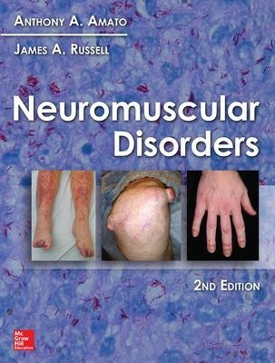 Neuromuscular Disorders - Anthony Amato, James Russell