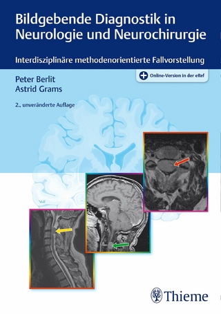 Bildgebende Diagnostik in Neurologie und Neurochirurgie - Peter-Dirk Berlit; Astrid E. Grams
