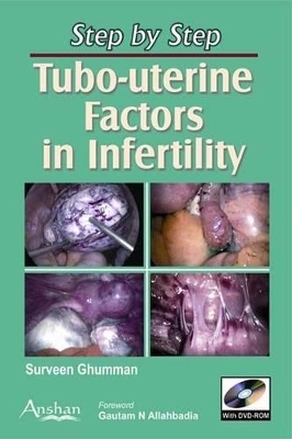 Tubo-uterine Factors in Infertility - Surveen Ghumman