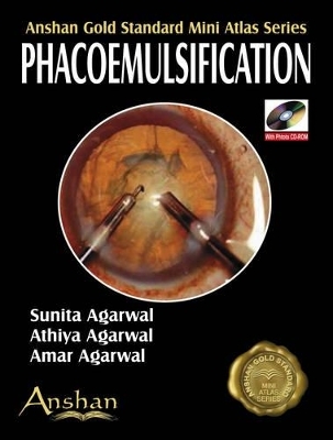 Mini Atlas of Phacoemulsification - Sunita Agarwal