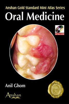 Mini Atlas of Oral Medicine - Anil Ghom