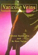 Varicose Veins - Harold Ellis, Peter Taylor