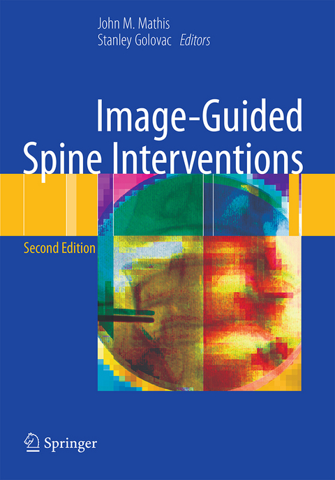 Image-Guided Spine Interventions - 