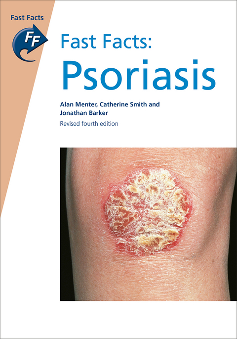 Fast Facts: Psoriasis - Alan Menter, Catherine Smith, Jonathan Barker