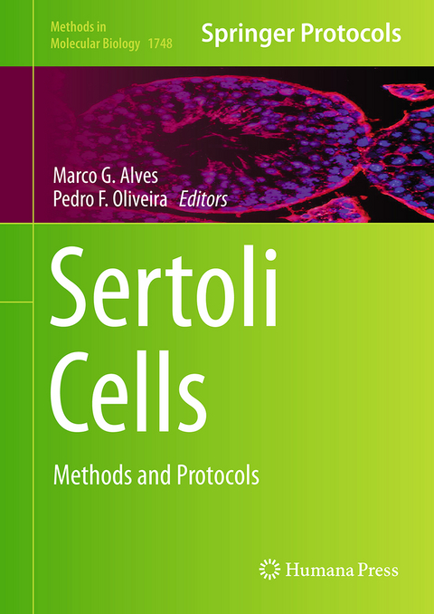 Sertoli Cells - 