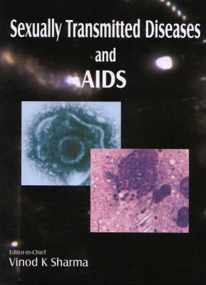 Sexually Transmitted Diseases and AIDS - Vinod Sharma