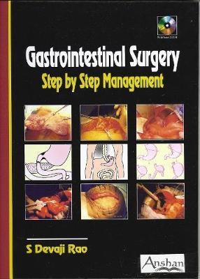 Gastrointestinal Surgery - S Devaji Rao