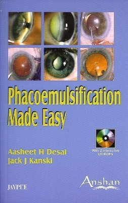 Phacoemulsification Made Easy - Aasheet Desai, Jack J Kanski