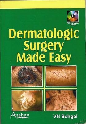 Dermatologic Surgery Made Easy - 