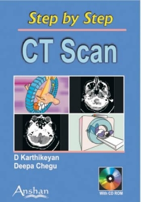 CT Scan - D. Karthikeyan, Deepa Chegu