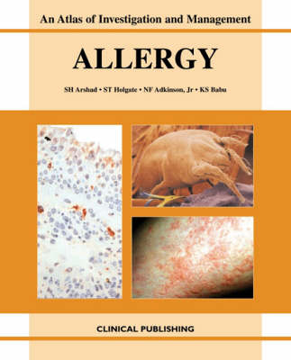 Allergy - 