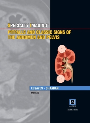 Specialty Imaging: Pitfalls and Classic Signs of the Abdomen and Pelvis - Khaled M. Elsayes, Akram A. Shaaban