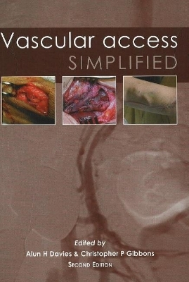 Vascular Access Simplified; second edition - 