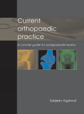 Current Orthopaedic Practice - Dr Sanjeev Agarwal