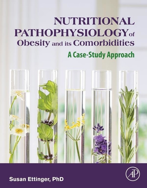 Nutritional Pathophysiology of Obesity and its Comorbidities -  Susan Ettinger