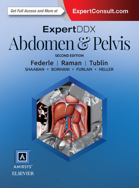 ExpertDDx: Abdomen and Pelvis E-Book -  Michael P. Federle,  Mitchell E. Tublin,  Siva P. Raman