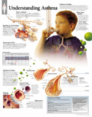 Understanding Asthma Laminated Poster -  Scientific Publishing