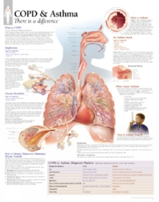 COPD & Asthma Laminated Poster -  Scientific Publishing