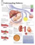 Understanding Diabetes Laminated Poster -  Scientific Publishing