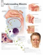 Understanding Rhinitis Laminated Poster -  Scientific Publishing