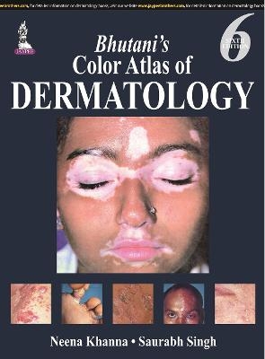 Bhutani’s  Color Atlas of Dermatology - Neena Khanna