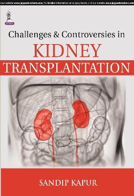 Challenges and Controversies in Kidney Transplantation - Sandip Kapur