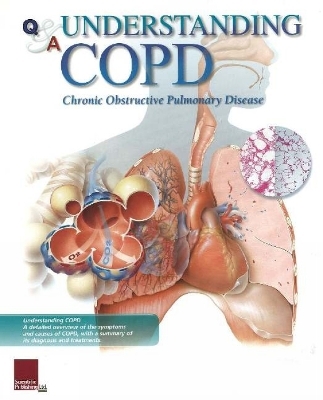 Understanding COPD Flip Chart -  Scientific Publishing