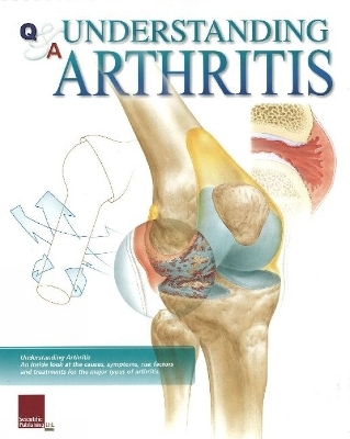 Understanding Arthritis Flip Chart -  Scientific Publishing