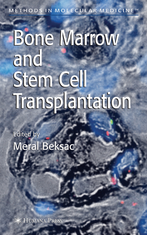 Bone Marrow and Stem Cell Transplantation - 