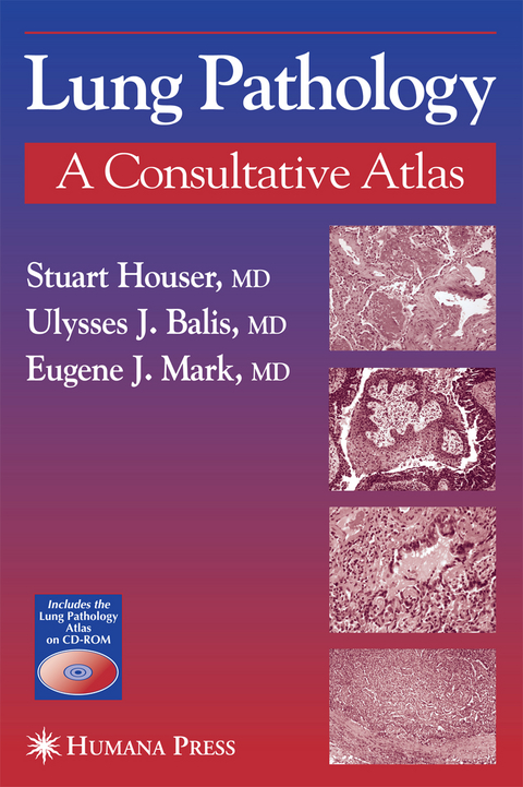 Lung Pathology - Stuart Houser, Eugene J. Mark, Ulysses J. Balis