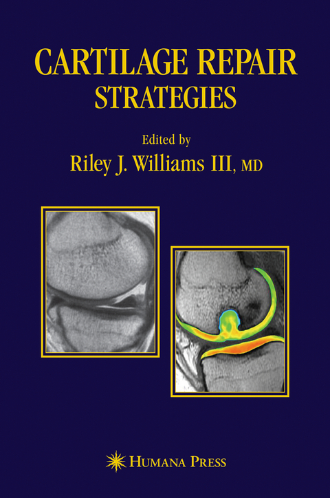 Cartilage Repair Strategies - 