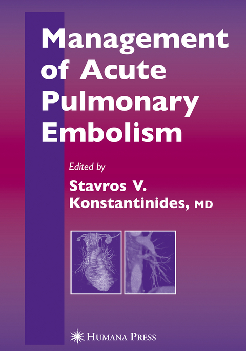 Management of Acute Pulmonary Embolism - 