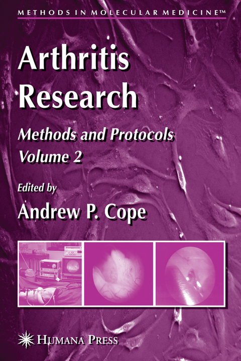 Arthritis Research - 