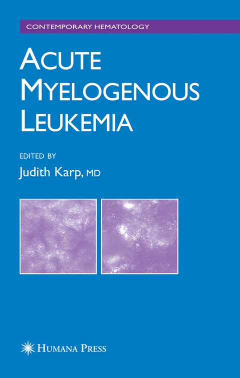 Acute Myelogenous Leukemia - 