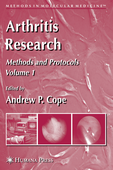 Arthritis Research - 