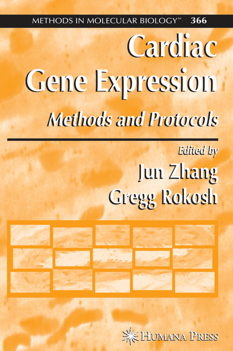 Cardiac Gene Expression - 